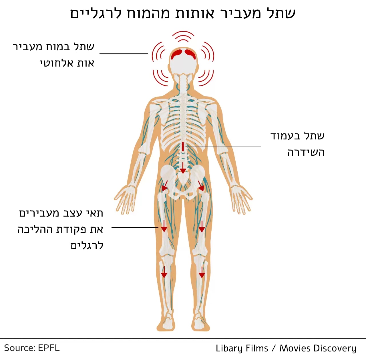 brain implant how it works hebrew